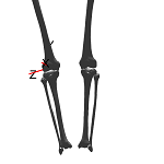KneeAnt.png