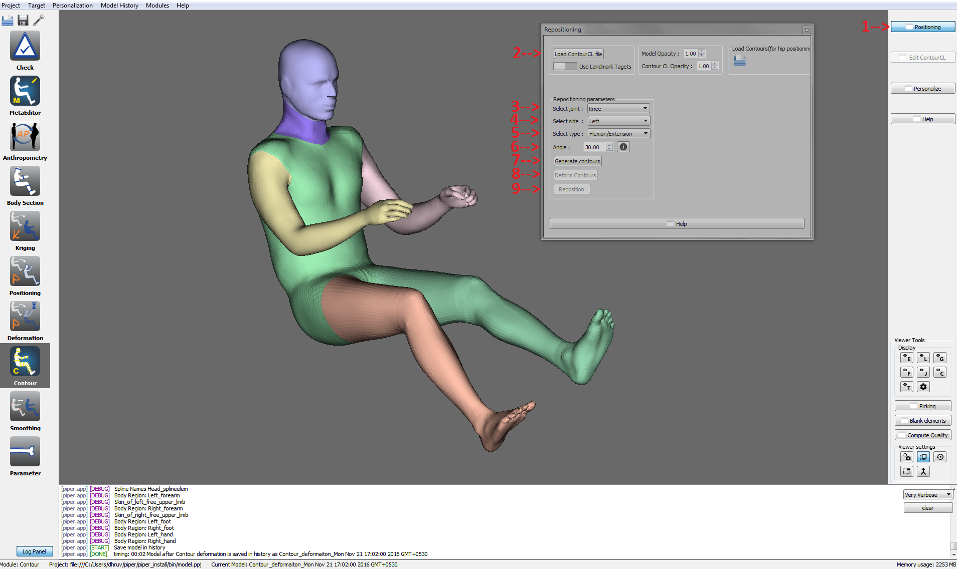 moduleContourDeformationReposSteps.png